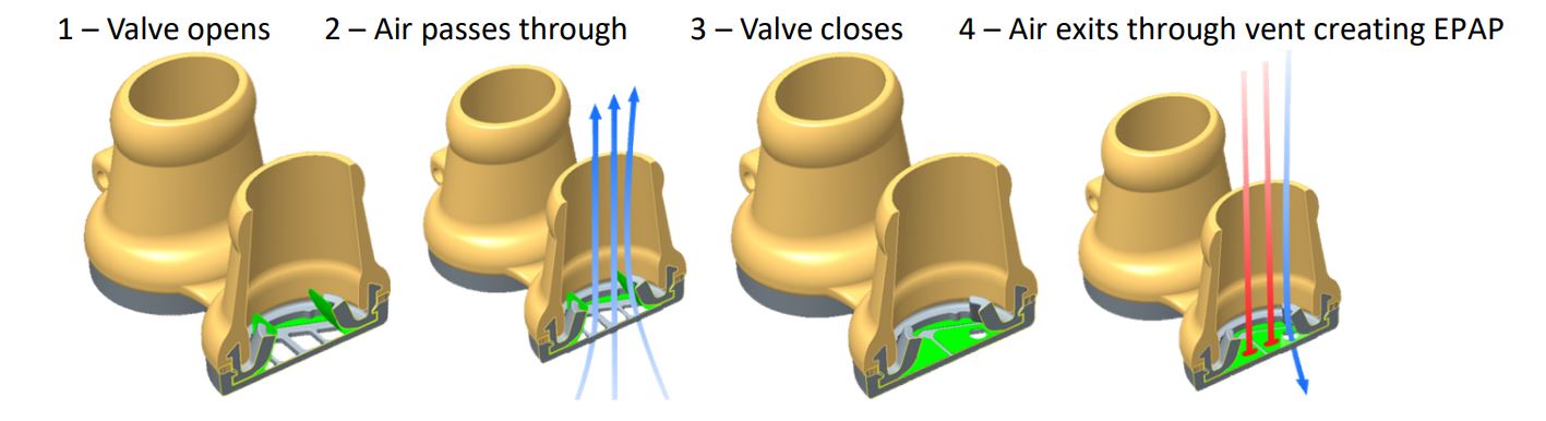 Bongo Rx Nasal EPAP